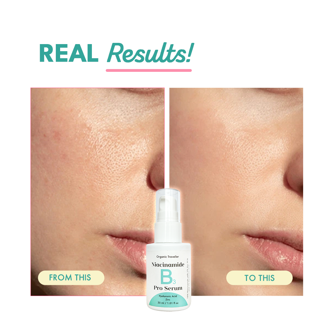 B3 PRO: Pore erasing serum