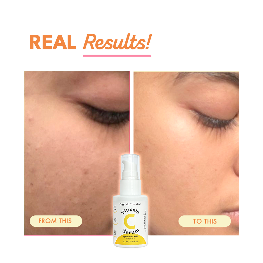 Super C: Vitamin C serum