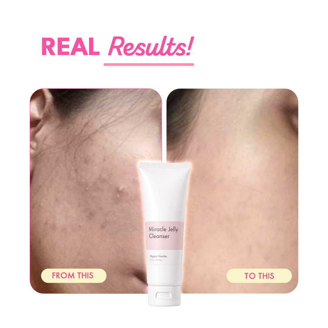 Miracle Jelly Daily Facewash