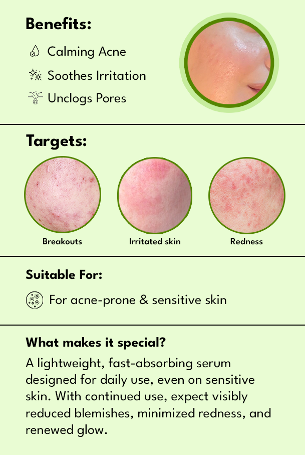 Acne Calming Serum