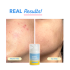 Rapid Repair: Barrier Repairing Moisturiser