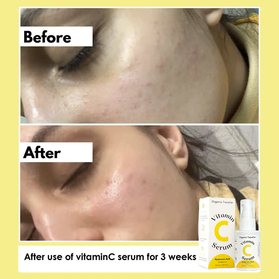 Super C: Vitamin C serum
