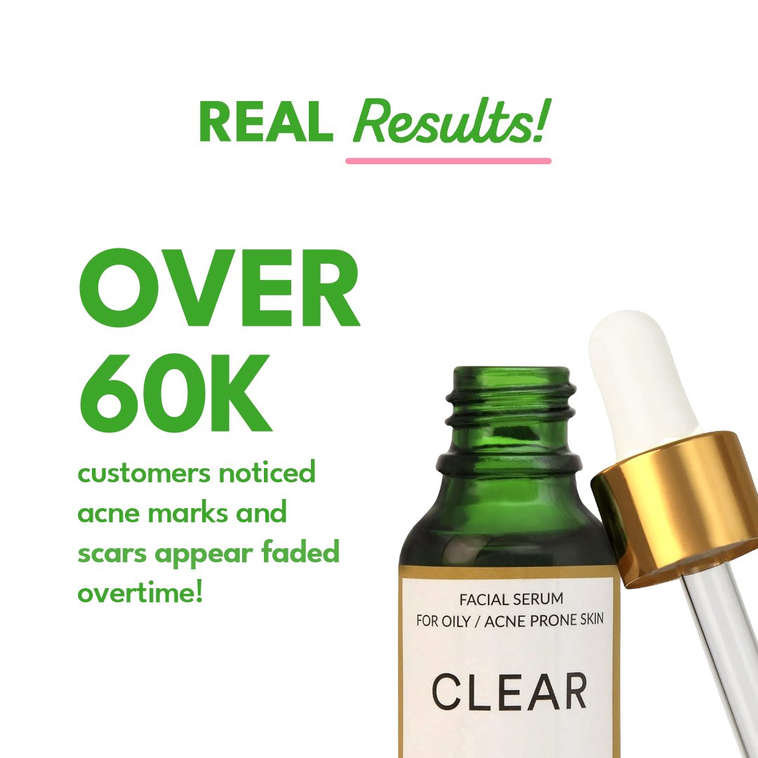 Clear: Acne clearing serum