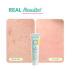 Sheer SPF: Oily/Acne Prone Skin Sunscreen (30 ML)