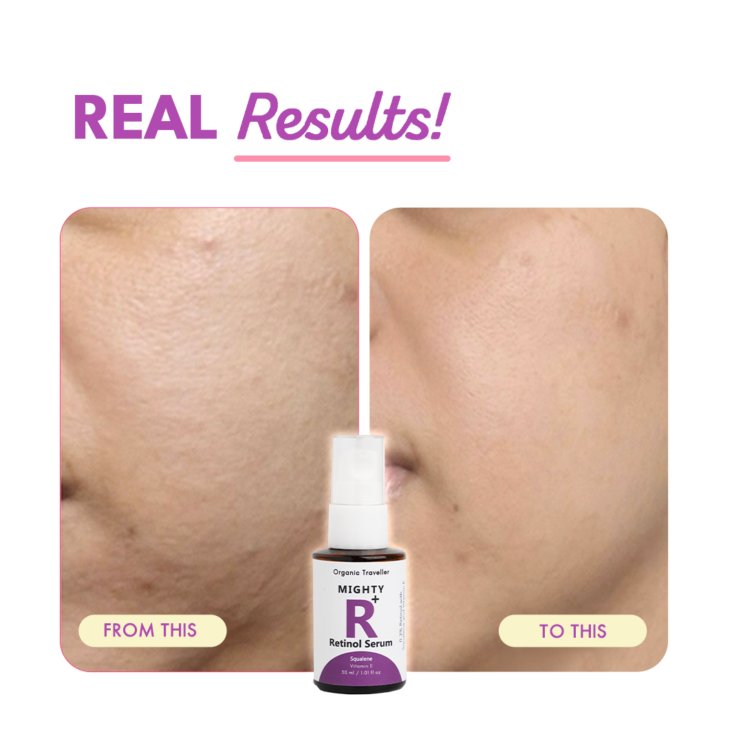 Mighty Retinol: Anti Ageing Serum