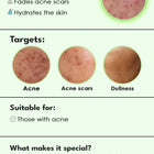 Clear: Acne clearing serum