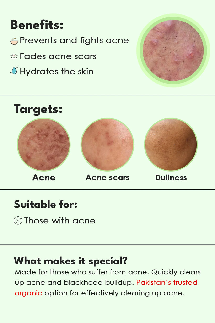 Clear: Acne clearing serum