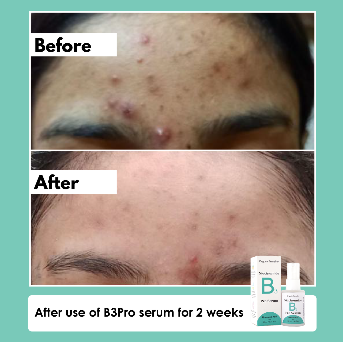 B3 PRO: Pore erasing serum - Organic Traveller Skincare 